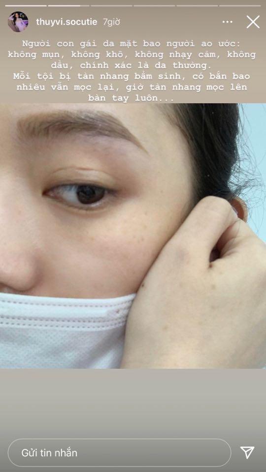 Làn Da có tàn nhang của Thúy Vi